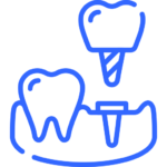 Overdenture și supraprotezări pe implanturi